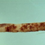 Monosporascus Root Rot showing brown regions on root